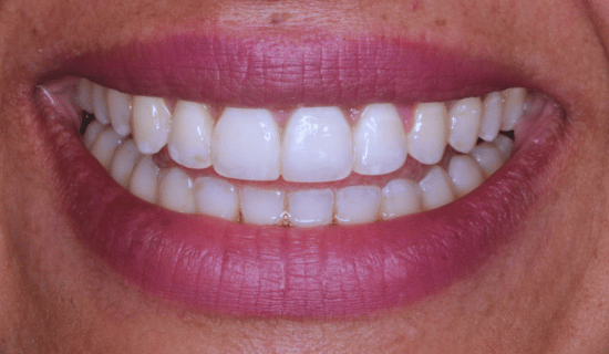 face - Dr Nina Shaffie