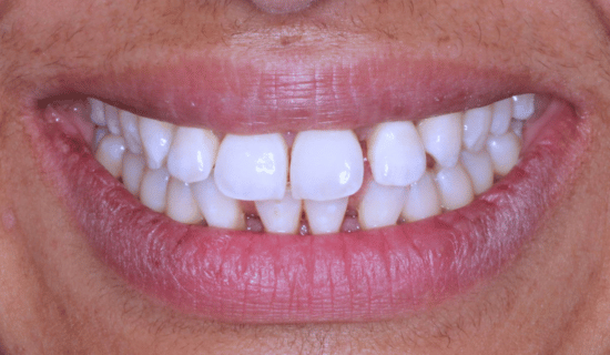 face - Dr Nina Shaffie