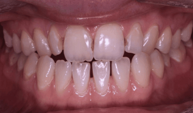 face - Dr Nina Shaffie