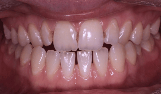 face - Dr Nina Shaffie