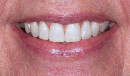 face - Dr Nina Shaffie
