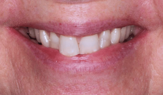 face - Dr Nina Shaffie